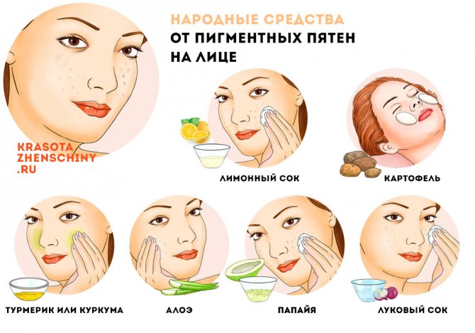 Как избавиться от пигментных пятен народные методы Как избавиться от пигментных пятен народные методы